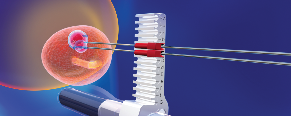 TRANSPERINEAL_TREATMENT_GUIDANCE-1200×480 (1)